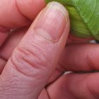 Lemon Tree Pest?