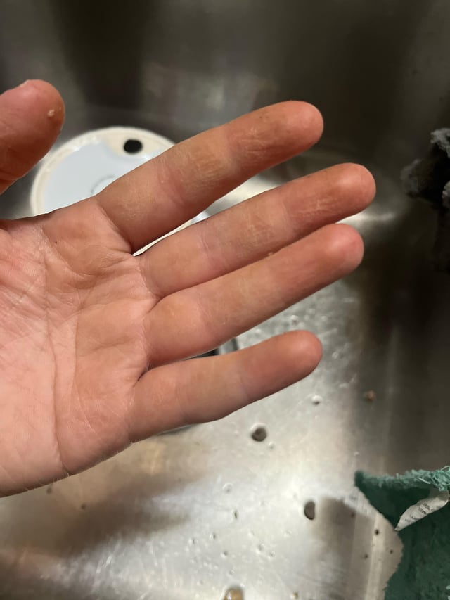 Today I learned I’m one of the people allergic to raw squash – Reddit Post